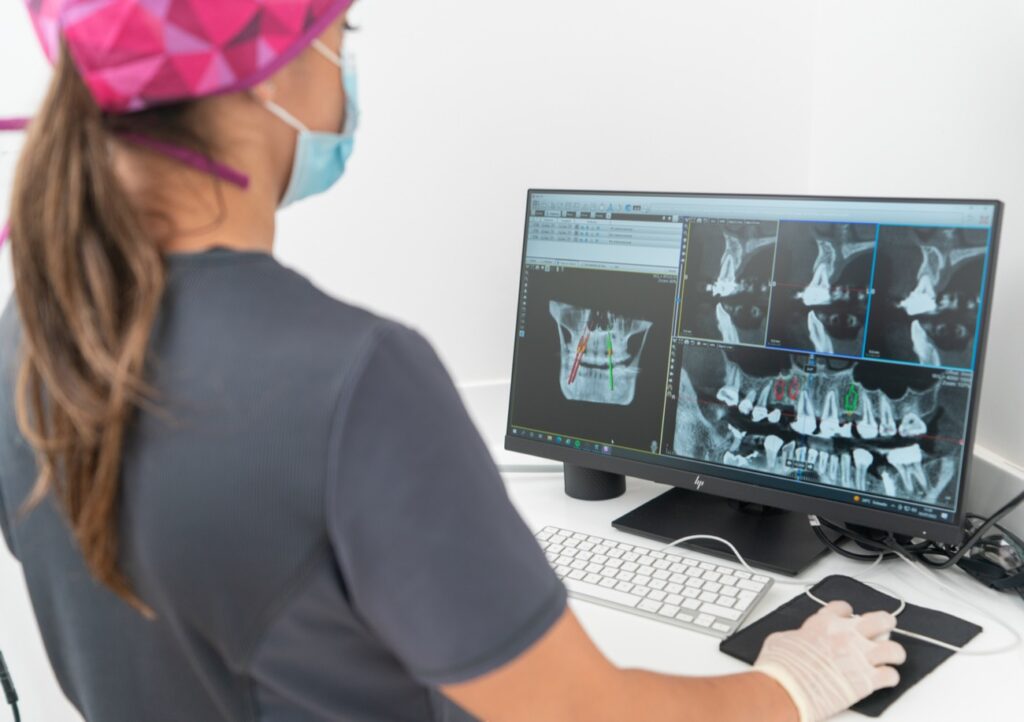 Implantes Dentales en Pamplona, Navarra